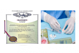 Áp dụng sáng chế đột phá trong phẫu thuật ghép giác mạc 